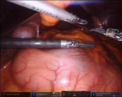 Sample image from SISVSE