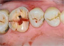 Sample image from Dentalai