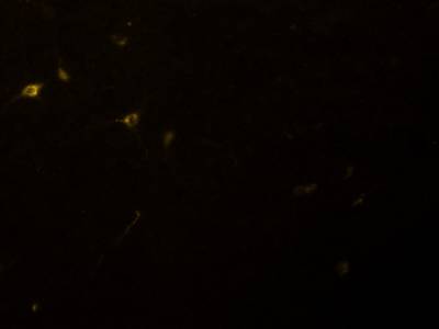 Sample image from Fluorescent Neuronal Cells