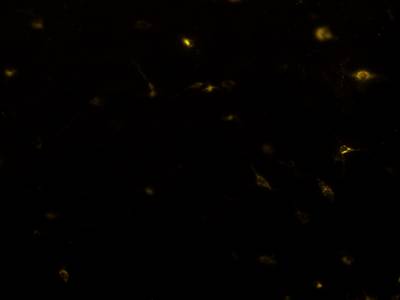 Sample image from Fluorescent Neuronal Cells