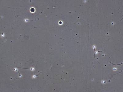 Sample image from VISEM-Tracking