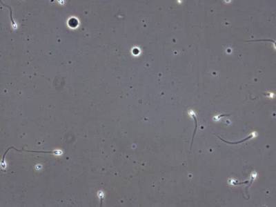 Sample image from VISEM-Tracking