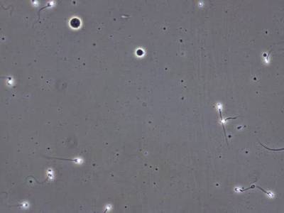 Sample image from VISEM-Tracking