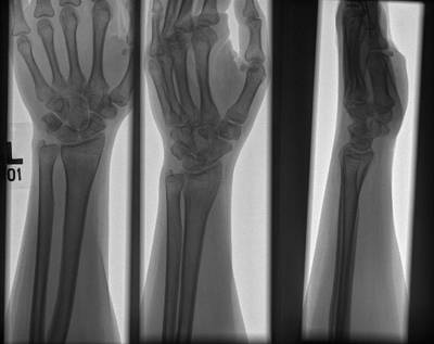 Sample image from Bone Classification and Detection Dataset