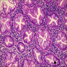 Sample image from EBHI-Seg