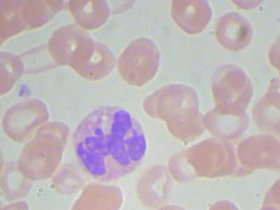 Sample image from BCCD