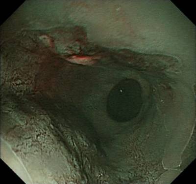 Sample image from EDD2020