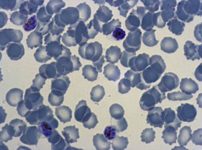 Sample image from Plasmodium Falciparum from Images of Giemsa for Malaria Detection
