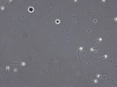 Sample image from VISEM-Tracking