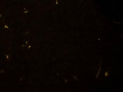 Sample image from Fluorescent Neuronal Cells
