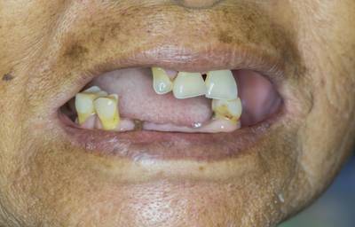 Sample image from Dentalai