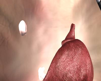 Sample image from SISVSE