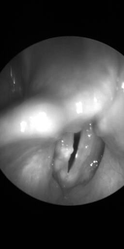 Sample image from BAGLS: Images