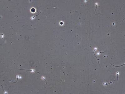 Sample image from VISEM-Tracking