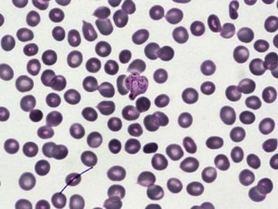 Sample image from BBBC041Seg
