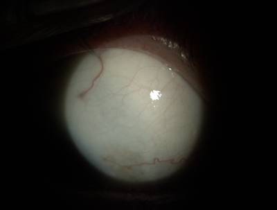 Sample image from Eyes Microcirculation