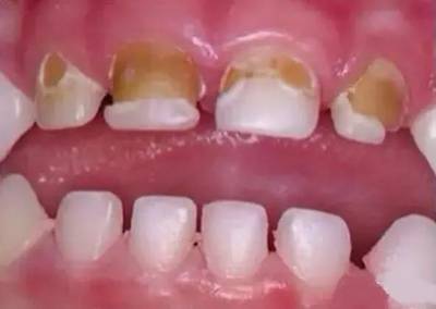 Sample image from Dentalai
