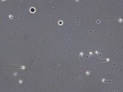 Sample image from VISEM-Tracking