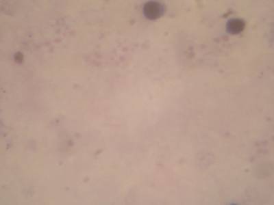 Sample image from Microscopy Malaria Dataset