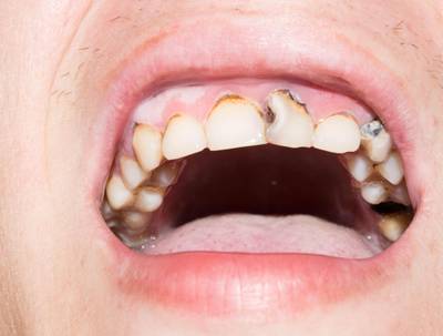 Sample image from Dentalai