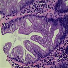 Sample image from EBHI-Seg