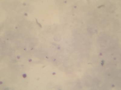Sample image from Microscopy Malaria Dataset