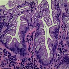Sample image from EBHI-Seg