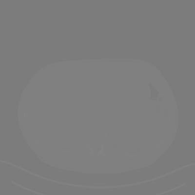 Sample image from DeepLesion