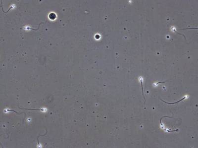 Sample image from VISEM-Tracking