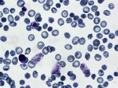 Sample image from BBBC041Seg