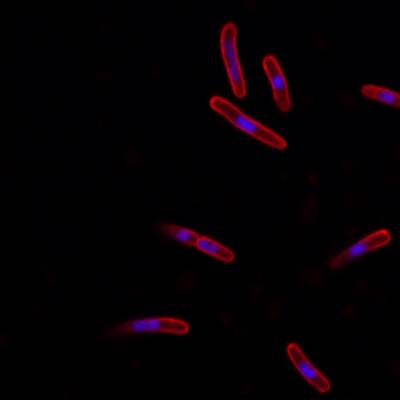 Sample image from DeepBacs E. Coli