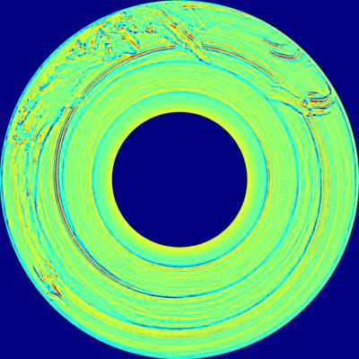 Sample image from BTAD