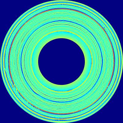 Sample image from BTAD