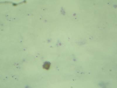 Sample image from Microscopy Malaria Dataset