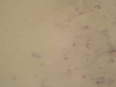 Sample image from Microscopy Malaria Dataset