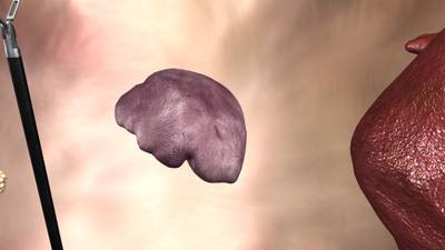 Sample image from SISVSE