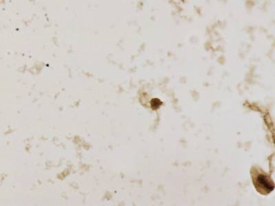 Sample image from CCAgT
