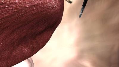 Sample image from SISVSE