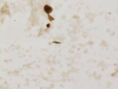 Sample image from CCAgT