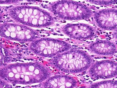 Sample image from GlaS@MICCAI'2015: Gland Segmentation