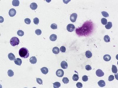 Sample image from BBBC041Seg