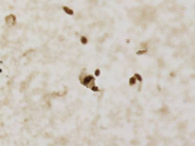 Sample image from CCAgT