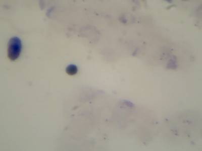 Sample image from Microscopy Malaria Dataset