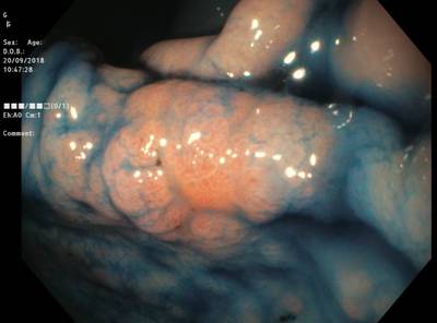 Sample image from EDD2020