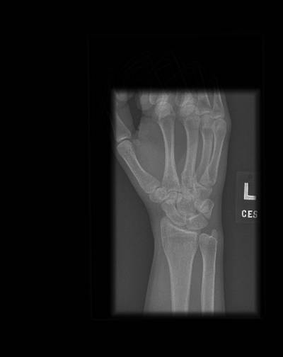 Sample image from Bone Classification and Detection Dataset