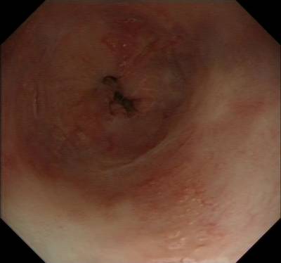 Sample image from EDD2020