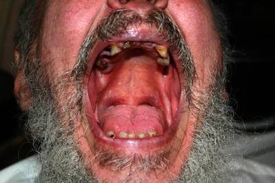 Sample image from Dentalai