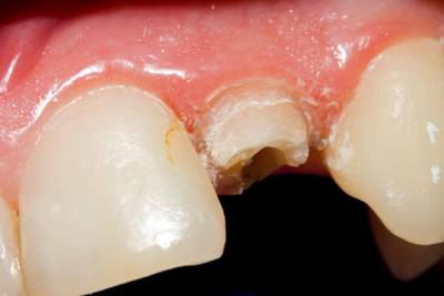 Sample image from Dentalai