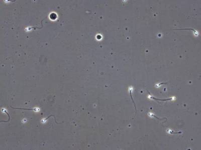 Sample image from VISEM-Tracking
