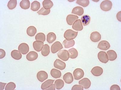 Sample image from Plasmodium Falciparum from Images of Giemsa for Malaria Detection
